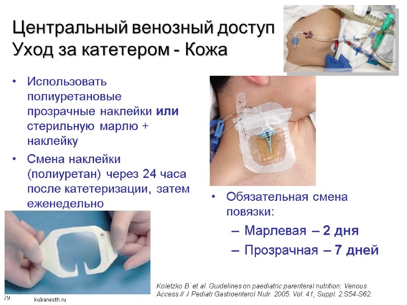 79 Центральный венозный доступ Уход за катетером - Кожа Использовать полиуретановые прозрачные наклейки или